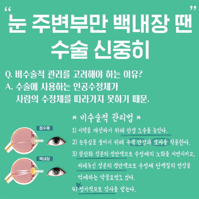 [HEALTH] 백내장 오면 수술부터 해야한다? 일상 큰 불편 없으면 관리부터 하세요!